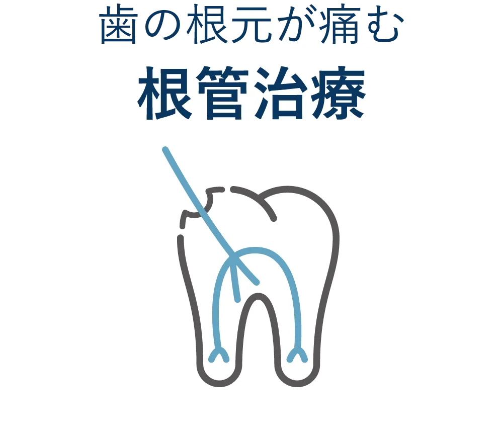 歯の根元が痛む 根管治療