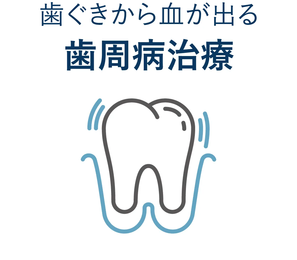 歯ぐきから血が出る 歯周病治療